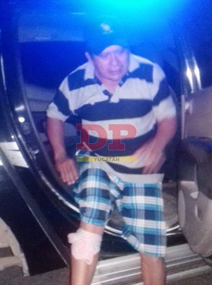 Mordisqueado por tremendo culebrón en Tizimín