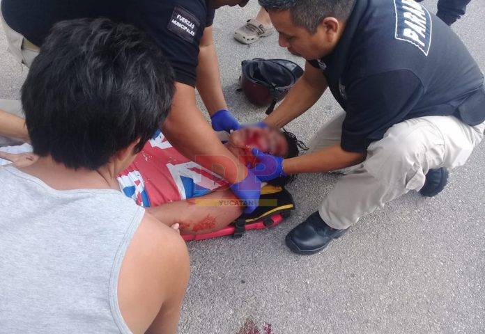 Se dio tremendo aporreón y derrapada en la carretera Chelem-Chuburná