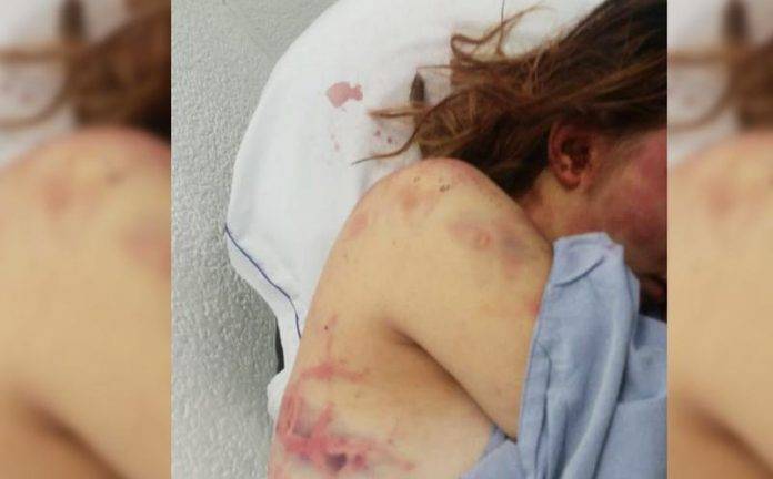 Pecho a pechito ¿karatazos a los derechos de la mujer?