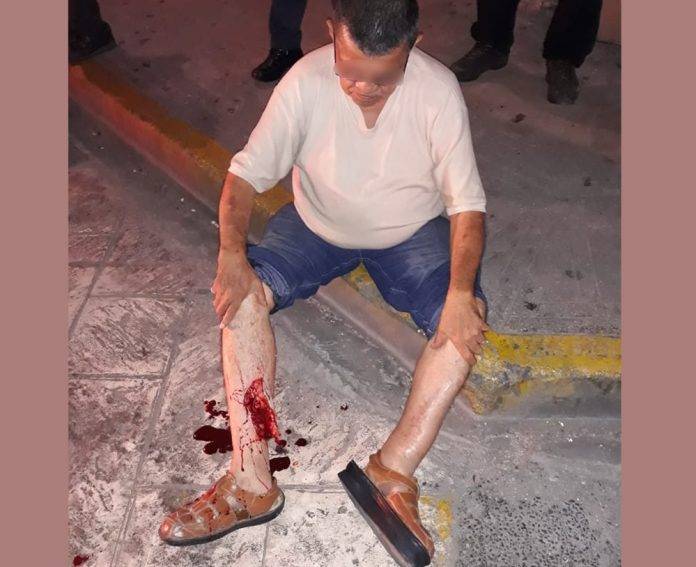 Motociclista y peatón atropellado resultan con severas lesiones