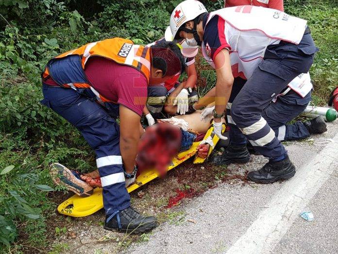 Brutal accidente en moto lo deja con la pierna hecha jalea (video)