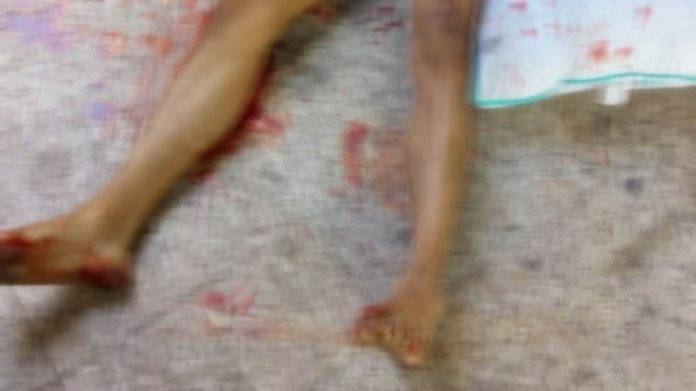 Adolescente acuchilla y mata a su novio en la CDMX