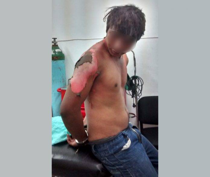 Joven de Umán quiso emular a la Antorcha Humana