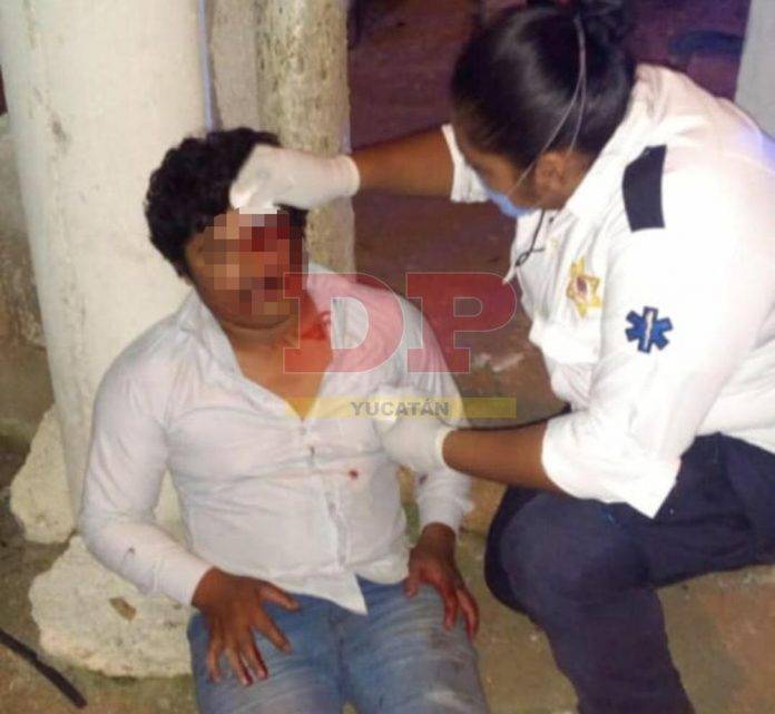 Le ganó el alcohol y se impactó en moto contra un poste de la CFE