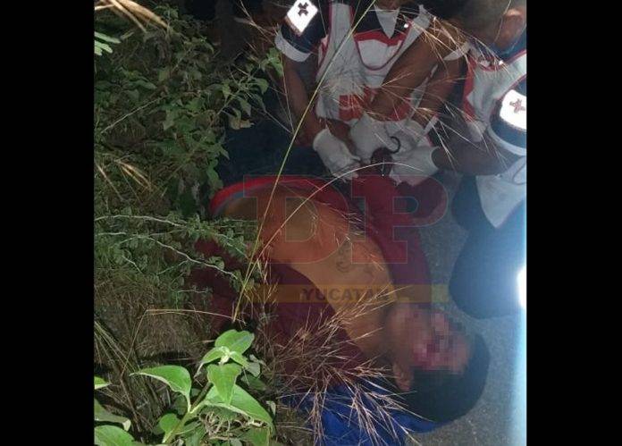Motociclista perjudicado luego de aterrizar con la cara