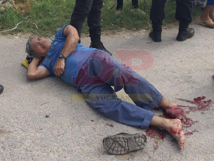 Motociclista embestido y lesionado por camioneta de la SSP