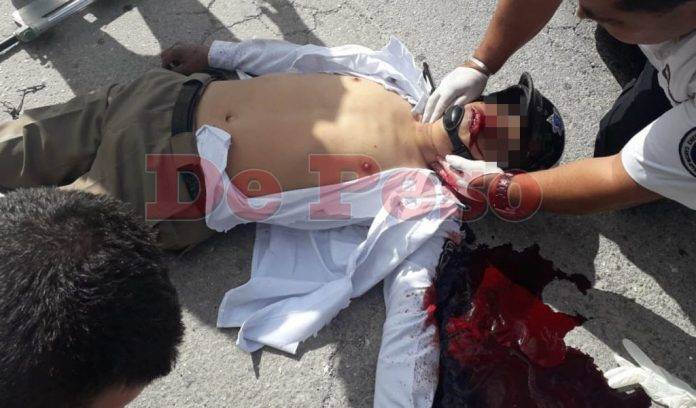 Camión arrolla a dos polis motonetos y uno muere