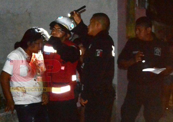Muchacha alcoholizada se accidenta a bordo de su moto