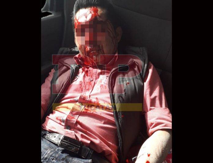 Termina la celebración bañado en su propia sangre