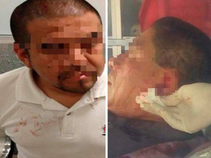 Se sintió Tyson y le arrancó un pedazo de oreja a su rival