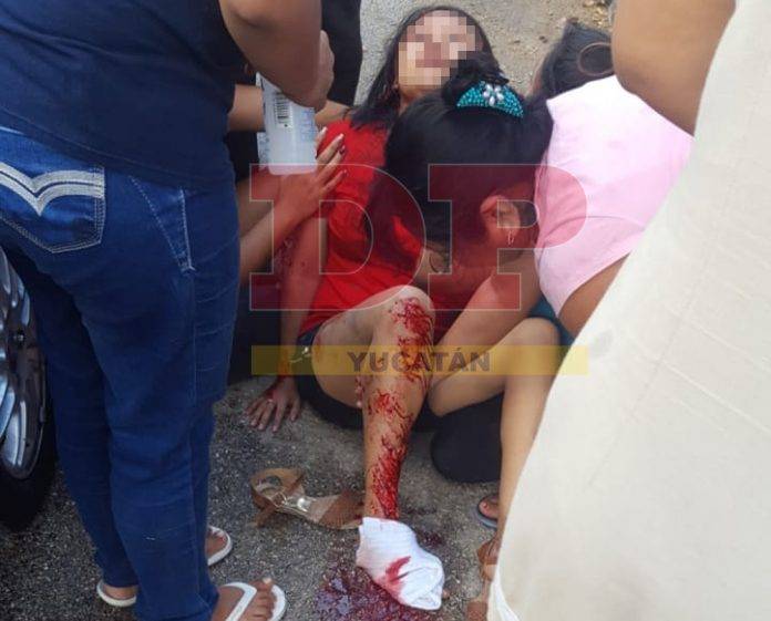 Casi se desmaya por el dolor de la herida que sufrió
