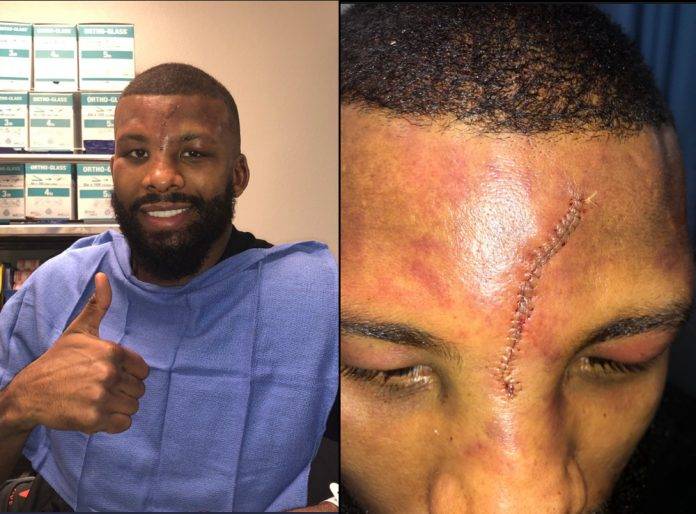 Boxeador 'presume' la herida que sufrió en combate