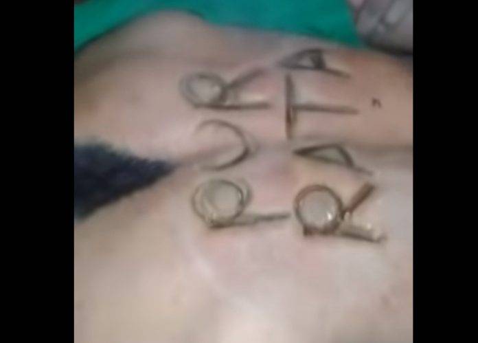 Como ganado marcan en la espalda a un ladrón