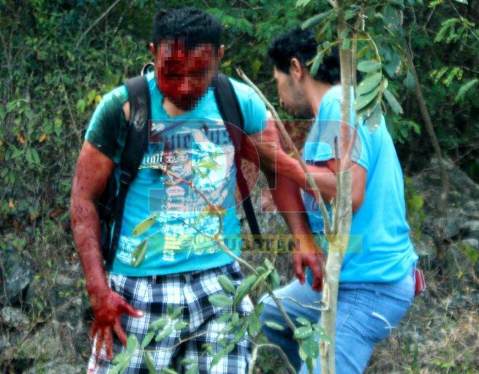 Salvaje aporreada se llevó motociclista sin casco