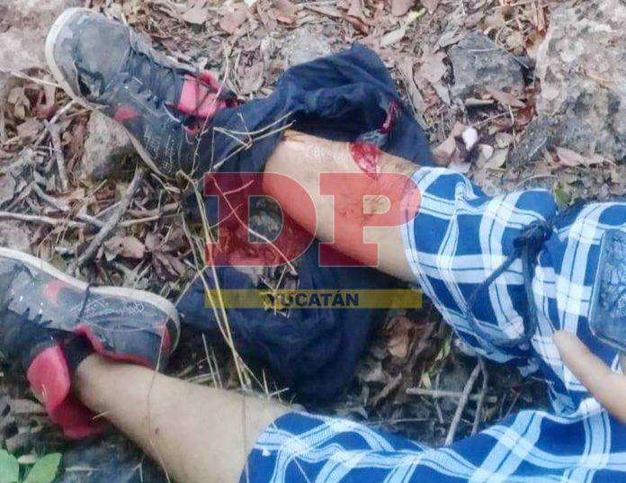 Tasajea su pata con un machetazo