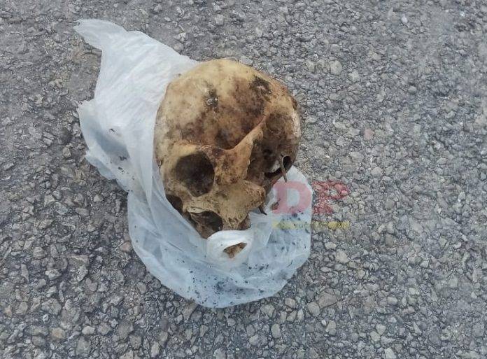 Algunos piensan que el cráneo llegó a la calle porque un perro lo trajo desde el cementerio.