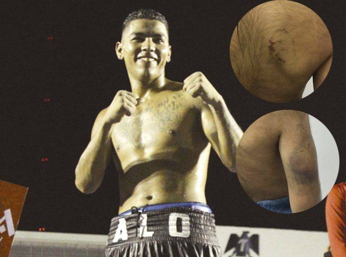 Dan 7 años de bote a boxeador que golpeó salvajemente a su hija