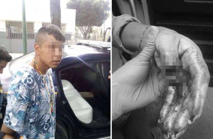A mordidas casi le arranca el dedo para robarle cartera y celular