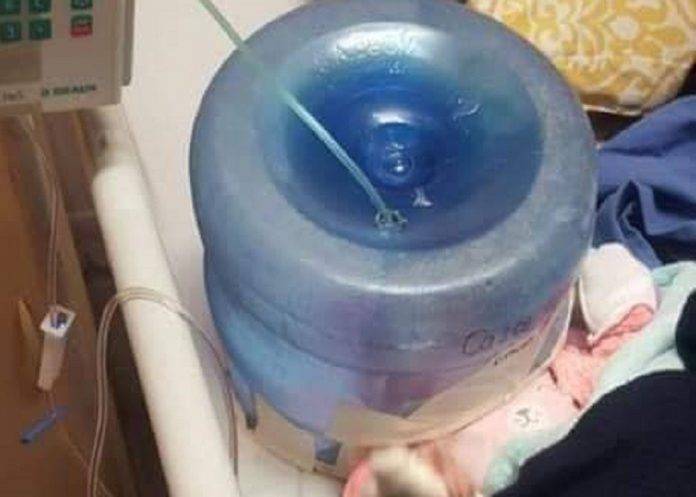 Centro de Salud usa garrafón como casco de oxígeno para una bebé