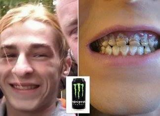 Bebida energética le deja podrida la dentadura Bebida energética le pudre la dentadura