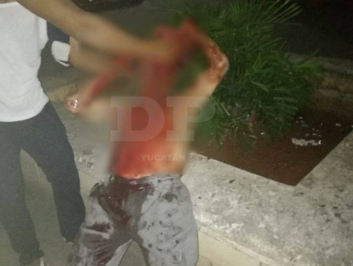 Pleito termina con un sordomudo bañado en sangre en Tizimín