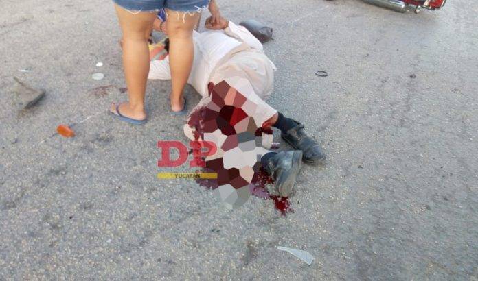 A un pobre hombre se le hicieron papilla prácticamente las dos piernas en accidente vial.