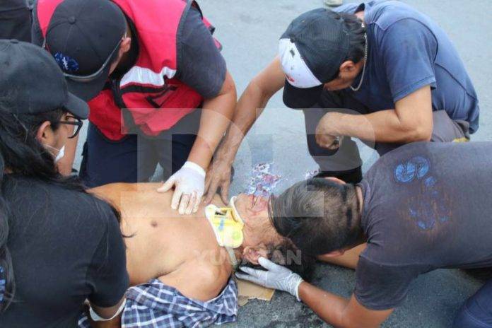 Por el fuerte golpe, el viejito quedó severamente lesionado
