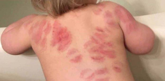 Mordieron a su hija 25 veces en un mismo día en guardería