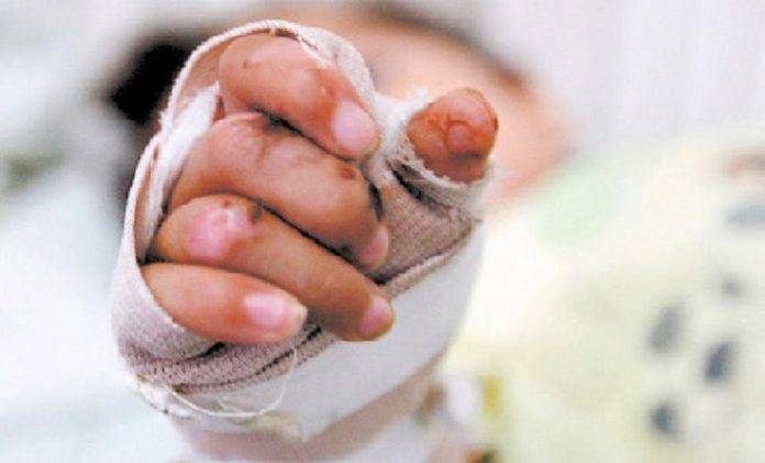 Indigente rocía gasolina a niño y muere quemado