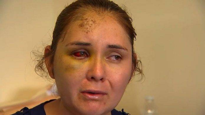 Mamá hispana en EU denuncia bullying escolar y chamaco agresor casi la mata