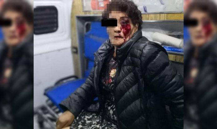 Policías propinan tremenda golpiza a doñita porque los 'cachó' durmiendo