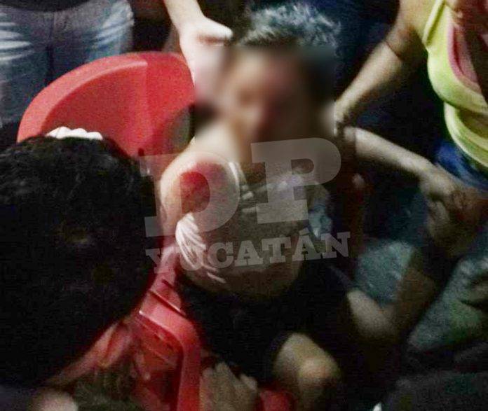 Perro malix manda a chavita a besar el pavimento; iba con su mamá en moto