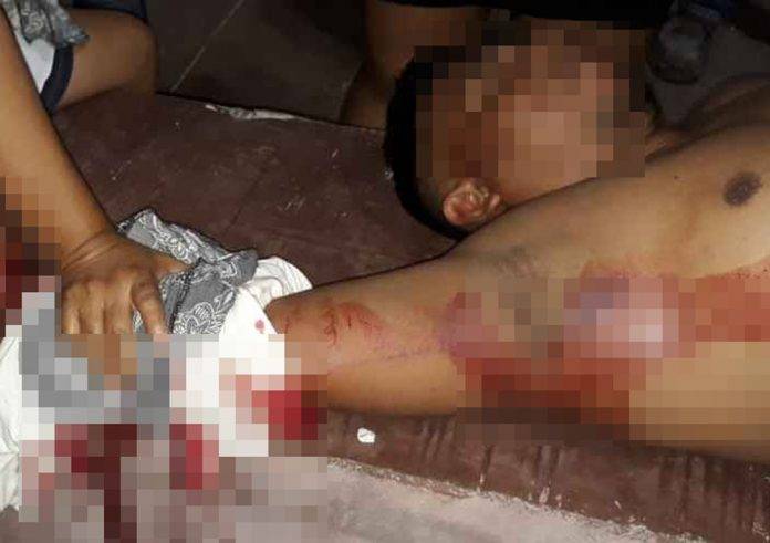 Cae con un cartón de misiles y se corta con los cristales rotos; casi se desangra