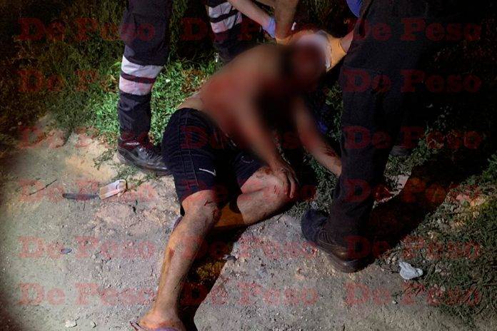 Ordena a su pitbull atacar y muerde salvajemente a un sujeto