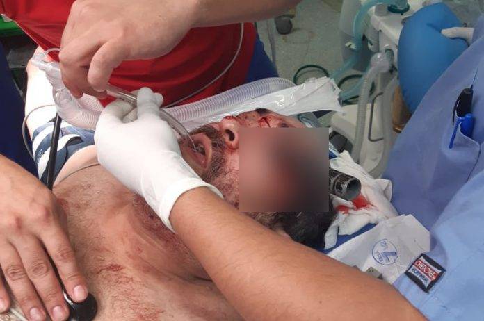 Médicos sacan el cuchillo clavado en el ojo de automovilista agredido