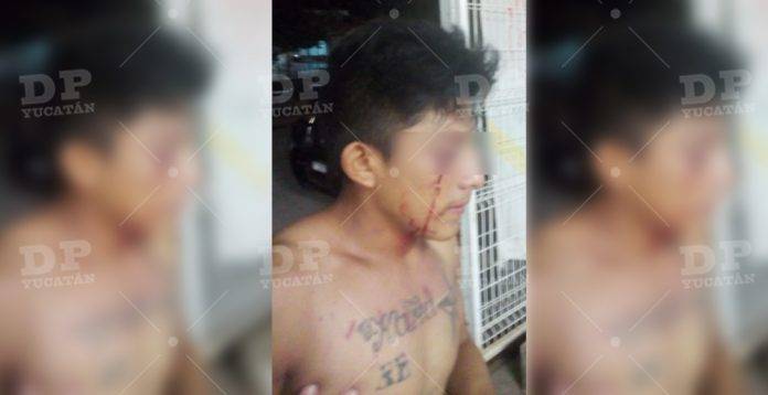 Peto: 'fierrazo' en el ojo lo manda al hospital