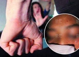 Yucatán: Sujeto tunde a golpes a su ex pareja a pesar de estar embarazada, en Buctzotz
