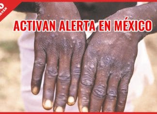 Secretaría de Salud emite alerta sanitaria por ‘Viruela del mono’
