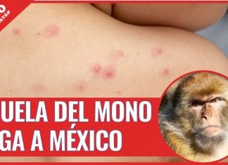 Confirman el primer caso de «Viruela del mono» en México
