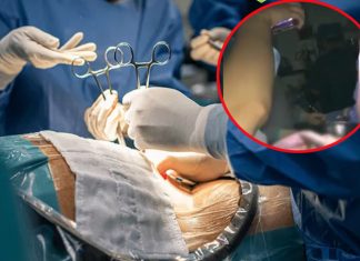 Tremenda negligencia: cortan oreja a bebé durante cesárea a media luz