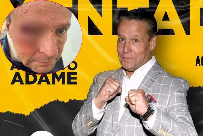 Alfredo Adame recibe golpiza a las puertas de su casa, de alguien que