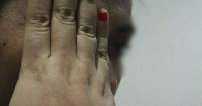 golpeada por marido