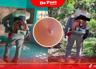 Poblador de Buctzotz sufre picadura de una ‘chinche besucona’ o pic